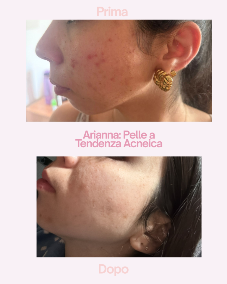 Caso studio: Luminosità