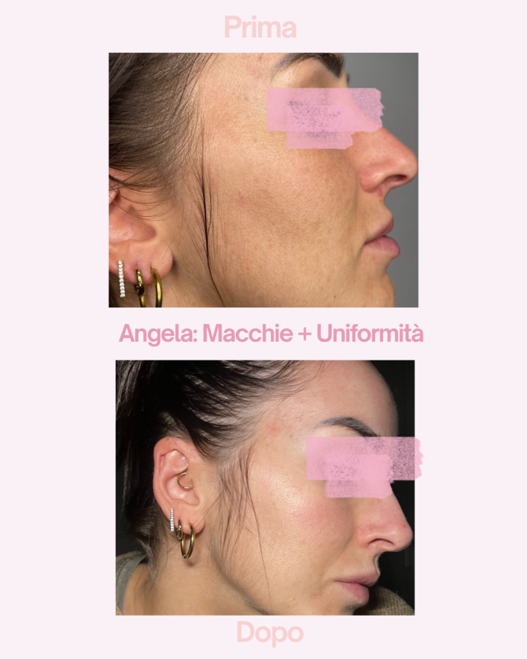 Caso studio: Texture e pori